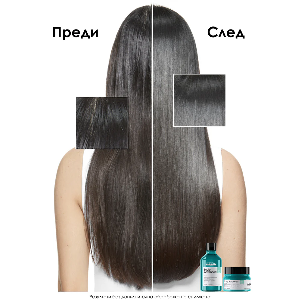 2 в 1 шампоан маска за дълбоко почистване за мазен скалп 250 мл - Image 3