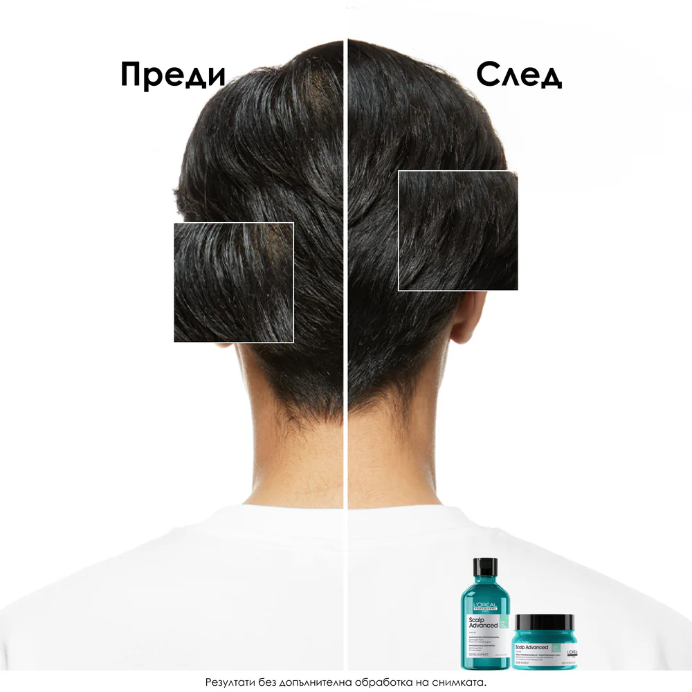 2 в 1 шампоан маска за дълбоко почистване за мазен скалп 250 мл - Image 4